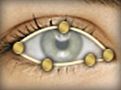 Trace Eye Example
